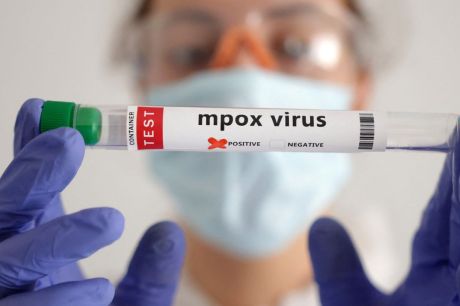 OMS estima custo de US$ 135 milhões em 6 meses para conter mpox